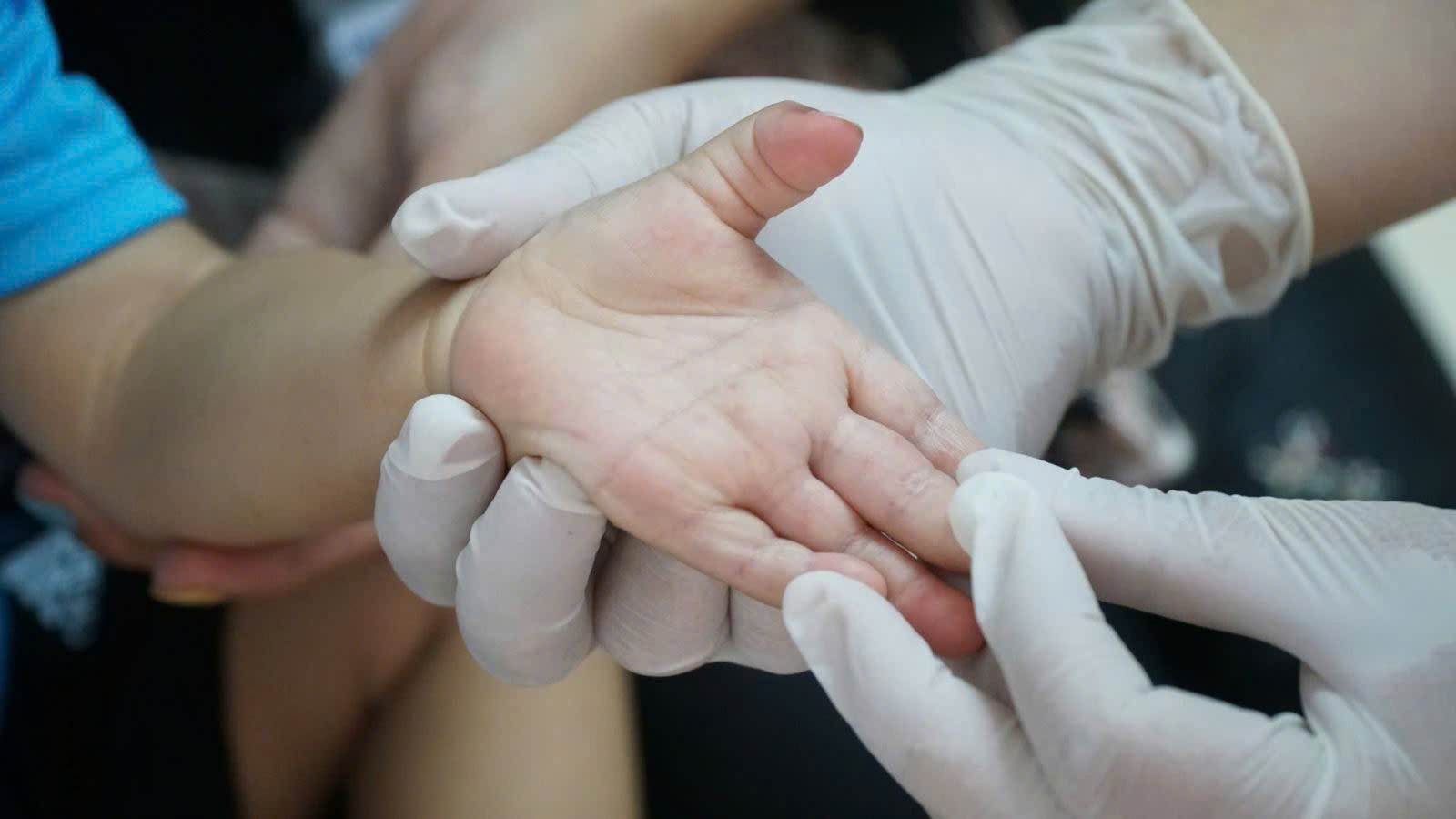 Đắk Lắk: Chủ động phòng, chống bệnh tay chân miệng đầu năm học mới