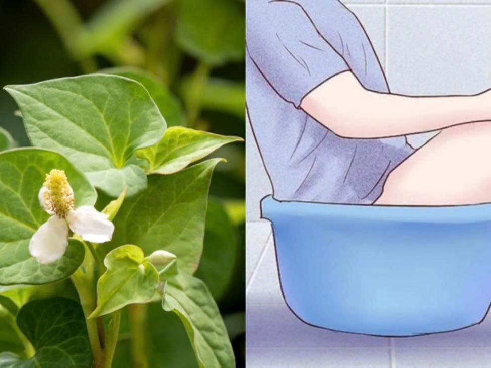 Mẹo trị bệnh trĩ nội và trĩ ngoại tại nhà bằng rau diếp cá Mẹo trị bệnh trĩ nội và trĩ ngoại tại nhà bằng rau diếp cá
