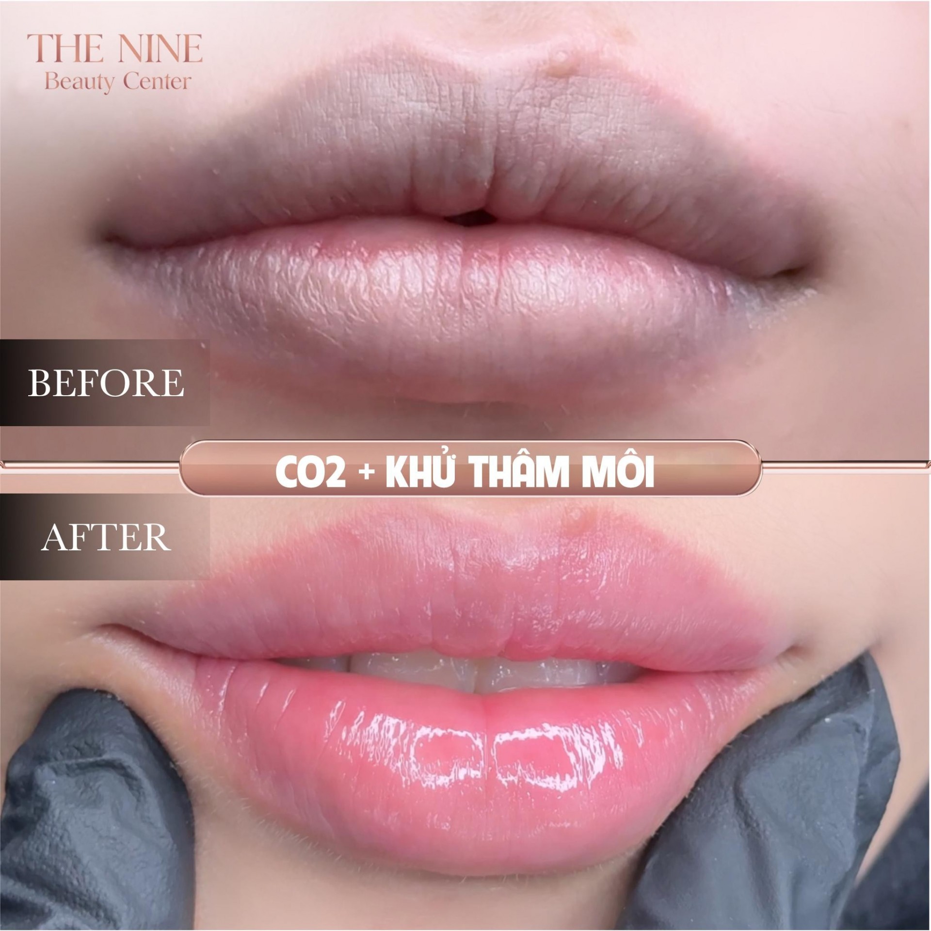 Nghệ thuật phun xăm cá nhân hoá tại The Nine Beauty Center - Kiến tạo vẻ đẹp bền vững theo thời gian.