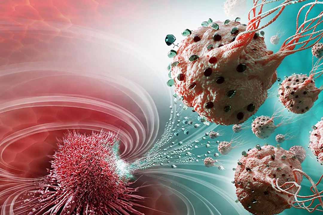 Béo phì làm tăng nguy cơ mắc nhiều bệnh ung thư