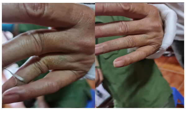 Lương Y Đỗ Văn Cần – Người giữ lửa Y học cổ truyền đất Văn Giang