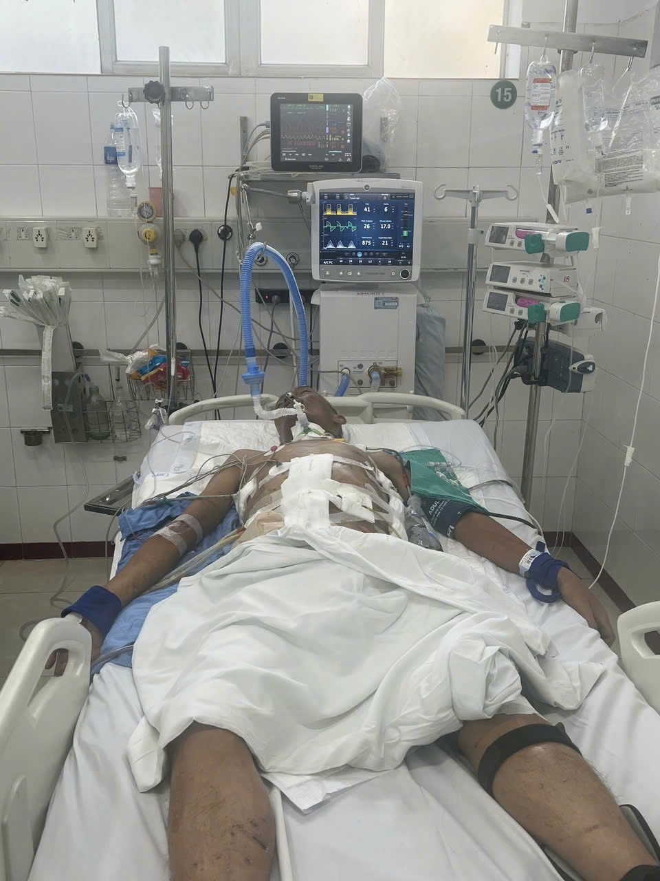 Kỳ tích hồi sinh tại Bệnh viện Việt Đức– Nơi trái tim và trí tuệ người thầy thuốc thắp lại sự sống Kỳ tích hồi sinh tại Bệnh viện Việt Đức– Nơi trái tim và trí tuệ người thầy thuốc thắp lại sự sống