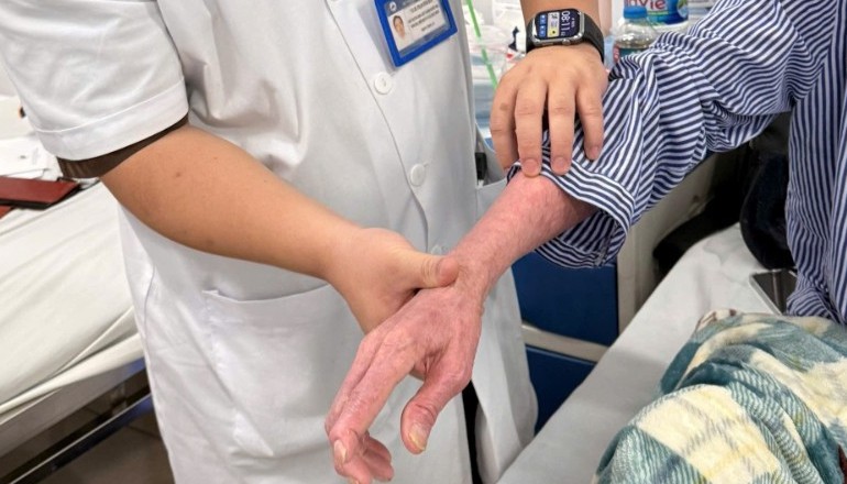 Loại bỏ bệnh da di truyền hiếm gặp nhờ phương pháp điều trị mới