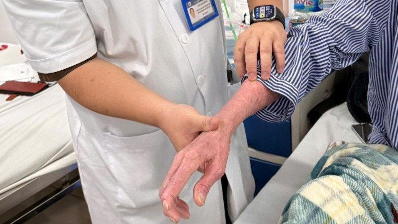 Loại bỏ bệnh da di truyền hiếm gặp nhờ phương pháp điều trị mới