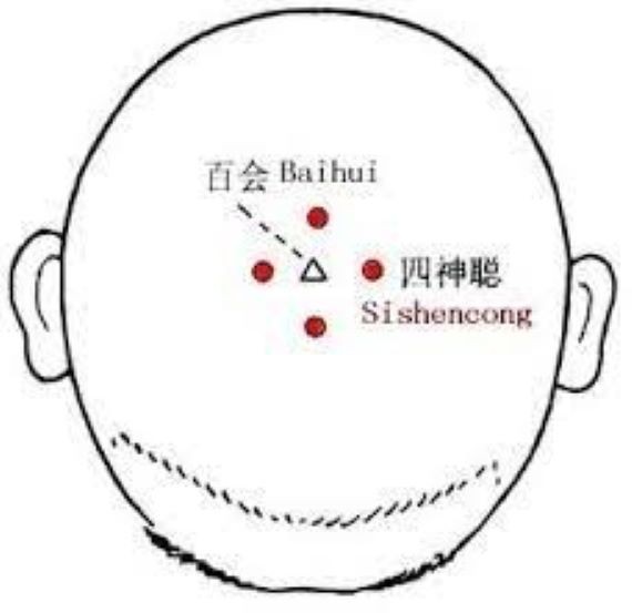 Y học cổ truyền phòng ngừa suy giảm trí nhớ