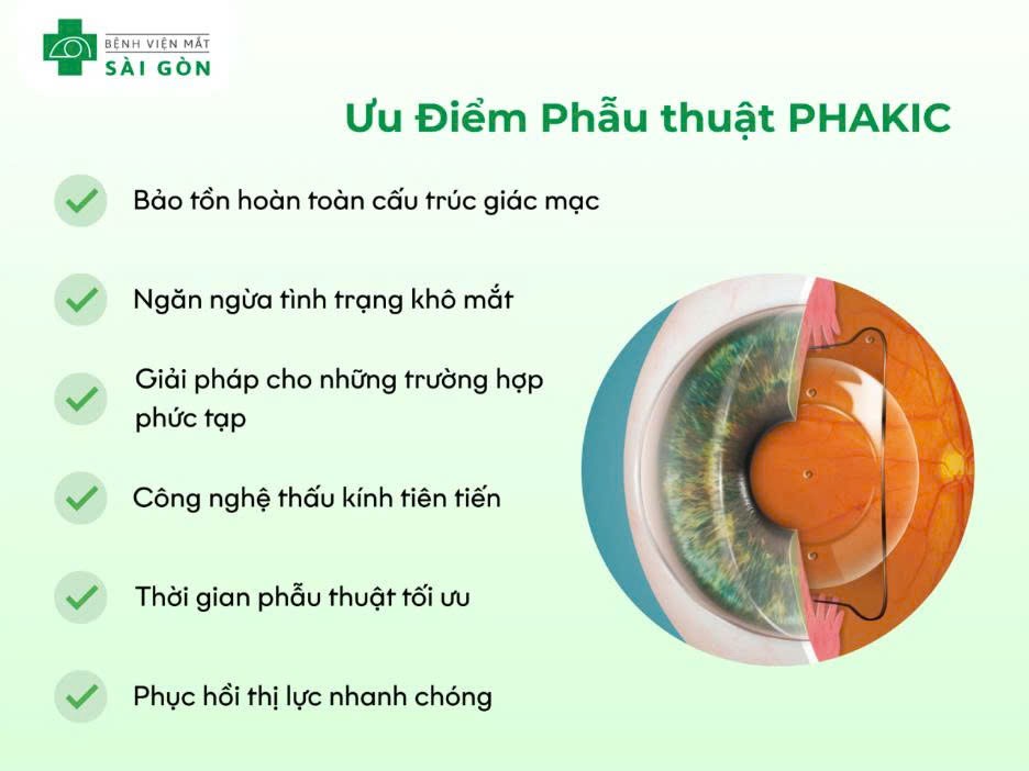 Tại sao nên chọn Phakic/Phakic để mổ cận/ loạn thị?