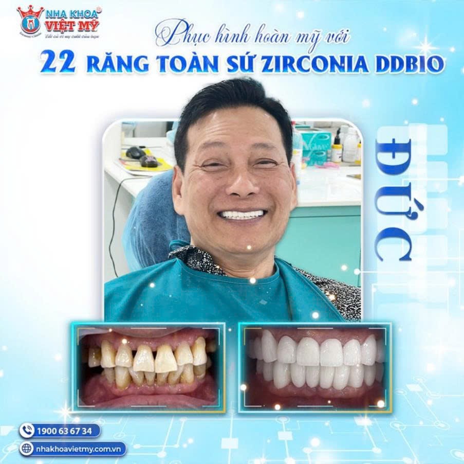 Nha khoa Việt Mỹ - Gần 2 thập kỷ đem đến dịch vụ bọc răng sứ thẩm mỹ chất lượng cao Nha khoa Việt Mỹ - Gần 2 thập kỷ đem đến dịch vụ bọc răng sứ thẩm mỹ chất lượng cao