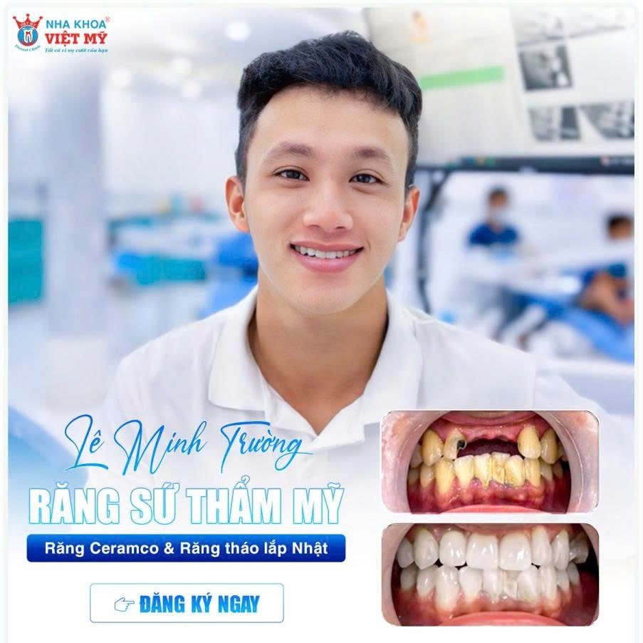 Nha khoa Việt Mỹ - Gần 2 thập kỷ đem đến dịch vụ bọc răng sứ thẩm mỹ chất lượng cao Nha khoa Việt Mỹ - Gần 2 thập kỷ đem đến dịch vụ bọc răng sứ thẩm mỹ chất lượng cao