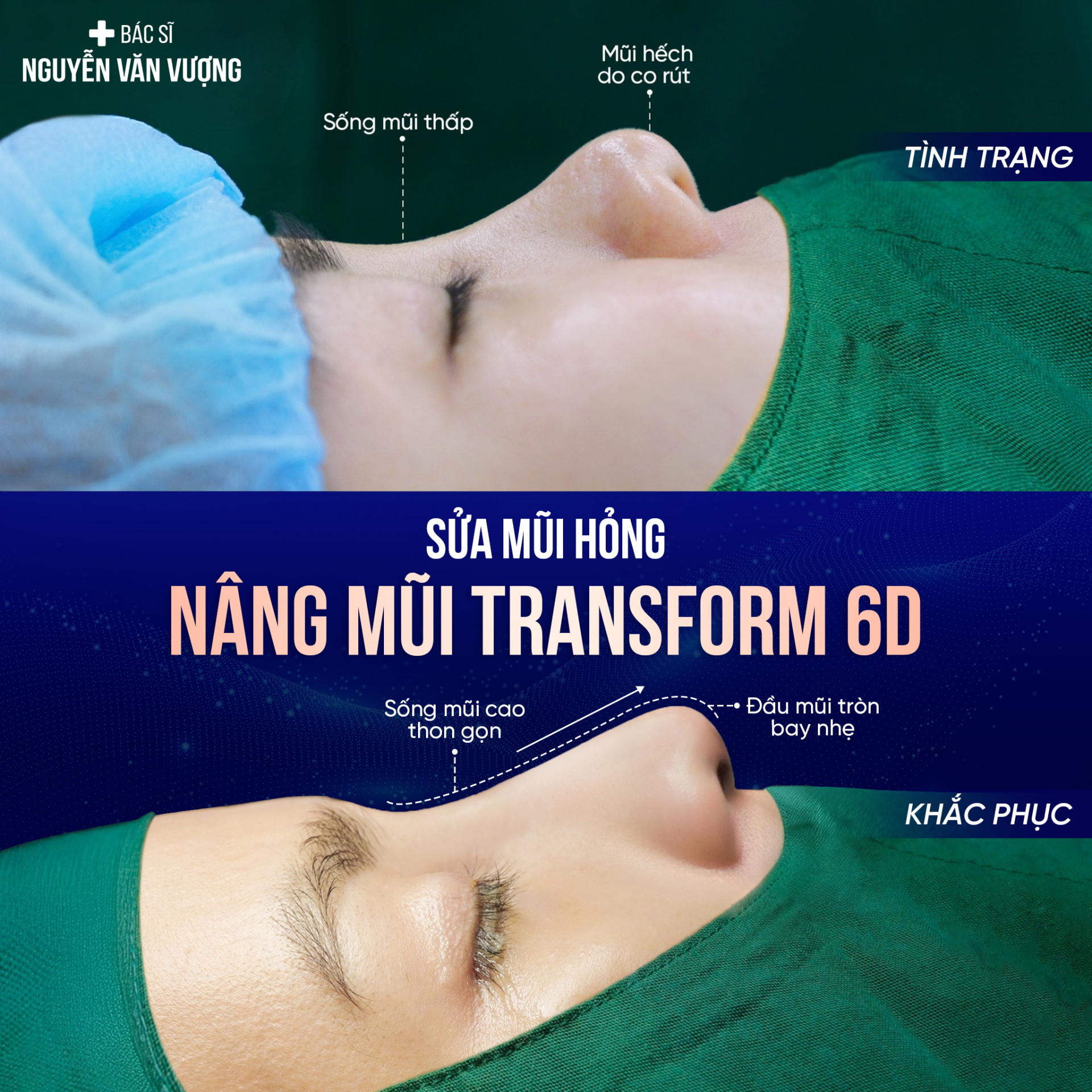 Những ca mũi khó – thử thách lớn, cũng là dấu ấn tay nghề của bác sĩ Nguyễn Văn Vượng