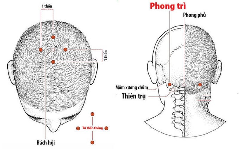 Huyệt Tứ Thần Thông: Ở đâu, Có Tác Dụng Gì Và Cách ấn Huyệt Chuẩn Y Khoa