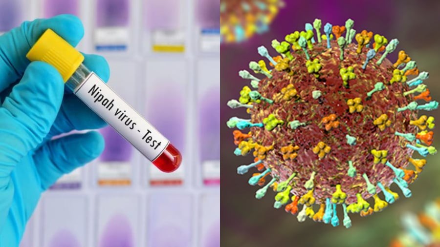 Virus Nipah là gì, mức độ nguy hiểm ra sao?