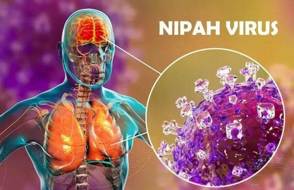 Virus Nipah không có nguy cơ bùng dịch lớn nếu thực hiện tốt các biện pháp phòng ngừa