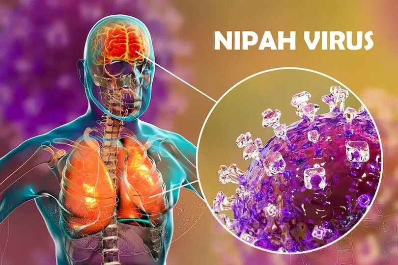 Virus Nipal không có nguy cơ bùng dịch lớn nếu thực hiện tốt các biện pháp phòng ngừa