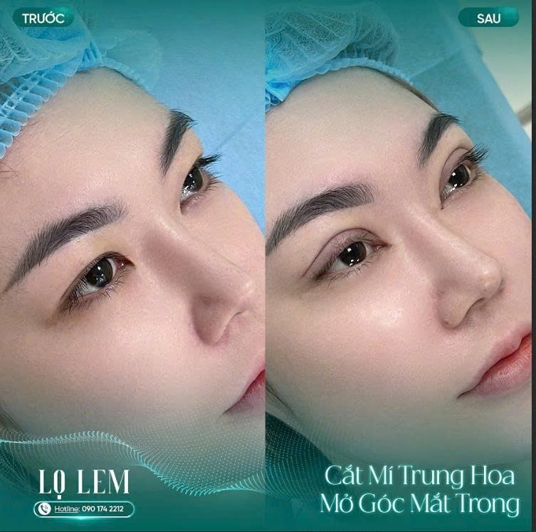 Phòng khám Chuyên khoa Thẩm mỹ Lọ Lem: Nơi sắc đẹp thăng hoa cùng những chuẩn mực an toàn