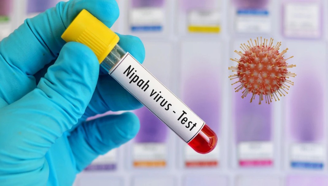 Bộ Y tế hướng dẫn chẩn đoán và điều trị bệnh do virus Nipah