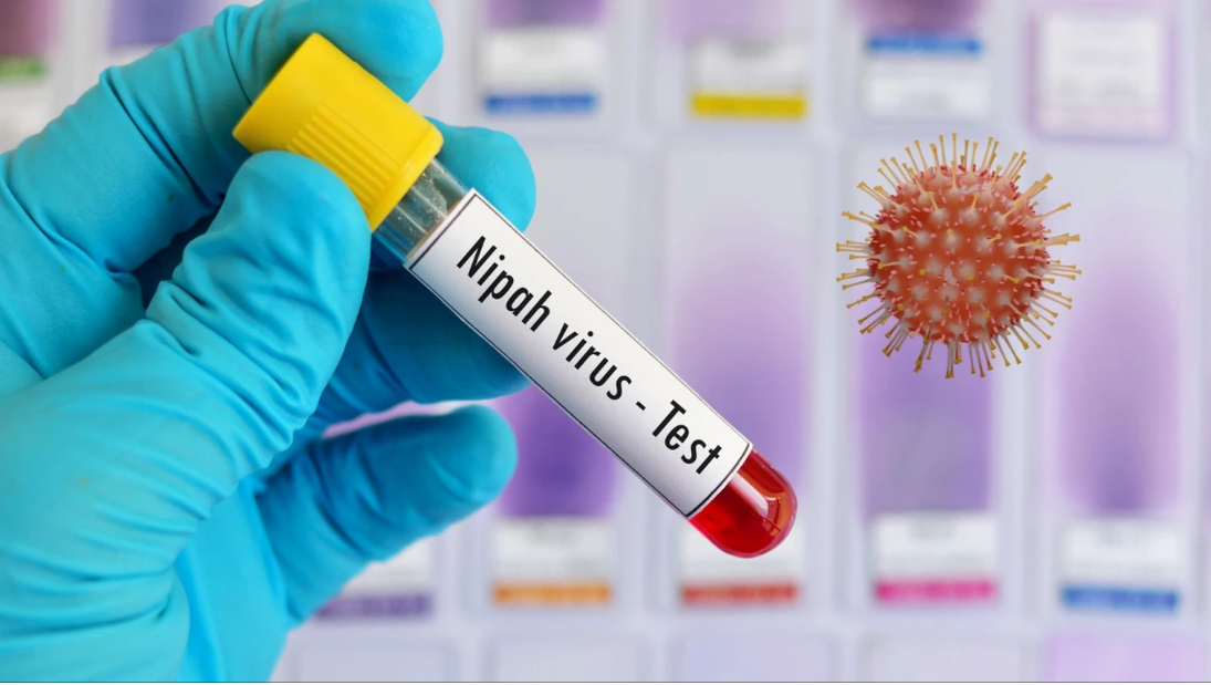 Bộ Y tế hướng dẫn chẩn đoán và điều trị bệnh do virus Nipah