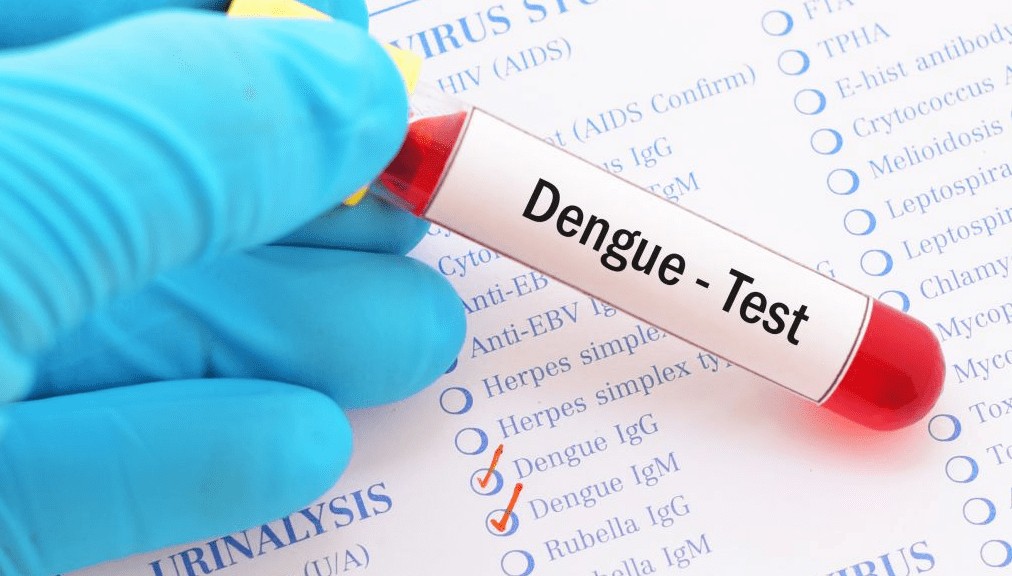 Việt Nam thử nghiệm thuốc kháng virus điều trị sốt xuất huyết