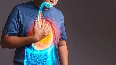 Các nguyên nhân gây ợ nóng thường gặp