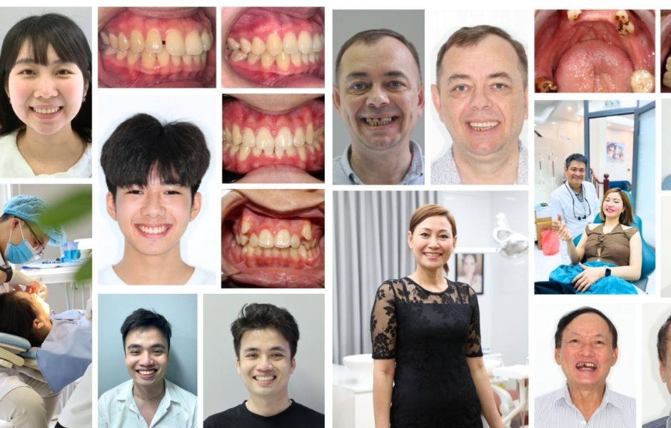 Nha khoa Bảo Việt – Đơn vị nha khoa uy tín tại Hà Nội, đồng hành cùng hàng nghìn nụ cười Việt