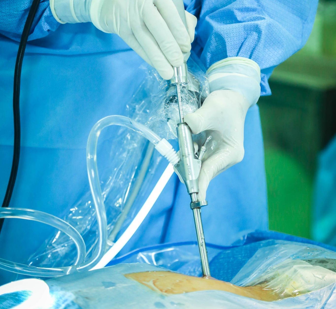 Bệnh lý cột sống: Bước tiến khoa học từ các kỹ thuật ít xâm lấn thế hệ mới