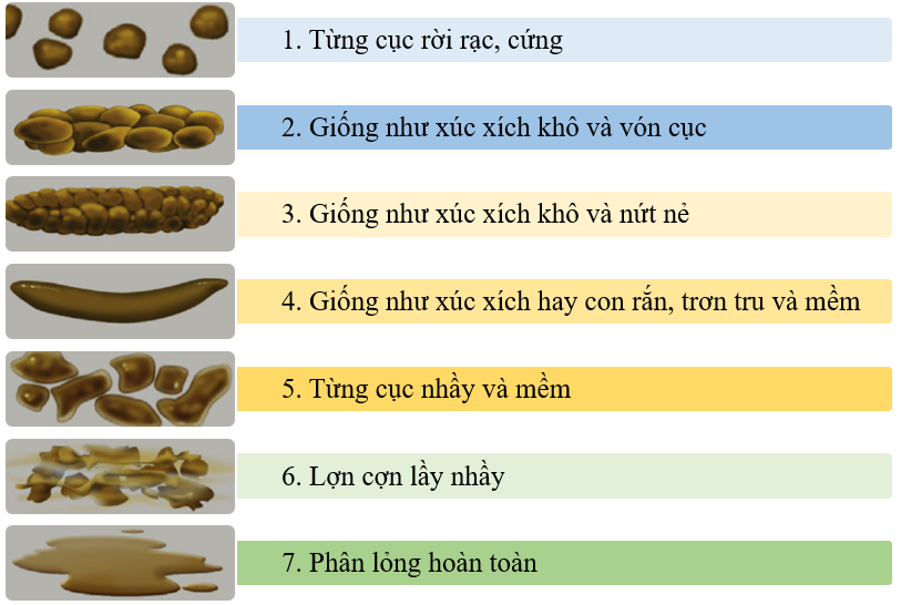 Tiếp cận chẩn đoán bệnh nhân táo bón mạn tính do đờ đại tràng
