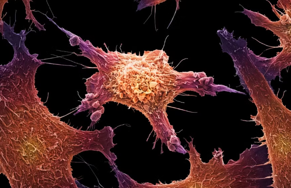 Xét nghiệm máu phát hiện đa ung thư: Khi công nghệ đi trước bằng chứng