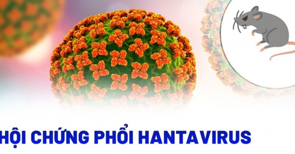 Việt Nam chưa ghi nhận ca bệnh do virus Hanta