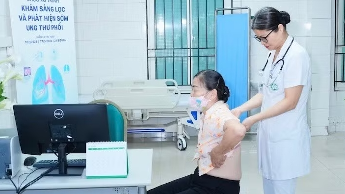 Mới có 10% số ca mắc ung thư phổi được phát hiện ở giai đoạn sớm