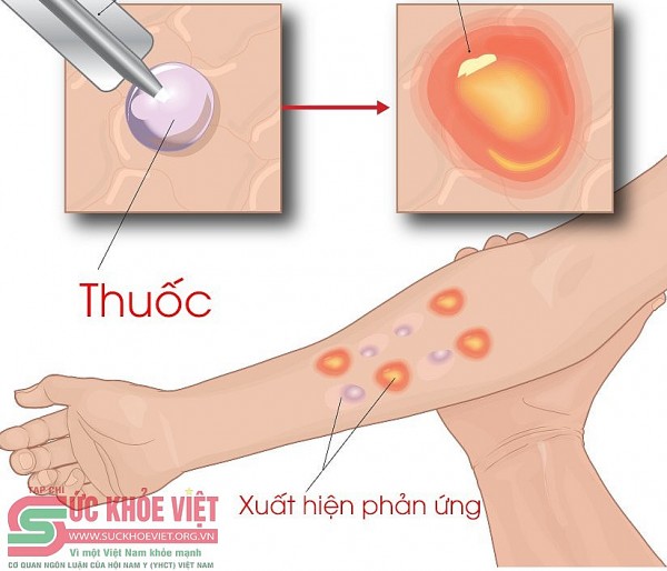 Bệnh viện E, Hùng Vương, Sản Nhi Phú Thọ mua thuốc của Công ty Dược phẩm Việt - Pháp khi chưa đủ hồ sơ nhập khẩu