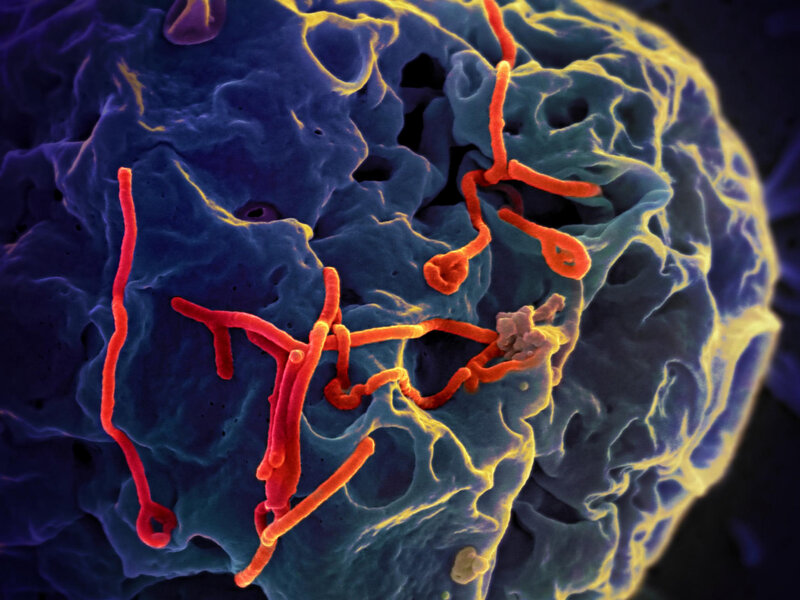 Bộ Y tế thông tin diễn biến phức tạp của dịch bệnh do virus Ebola Bộ Y tế thông tin diễn biến phức tạp của dịch bệnh do virus Ebola
