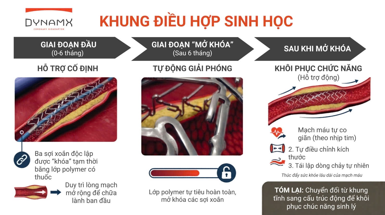 DynamX Bioadaptor có cấu trúc các khớp nối tự tách đặc biệt, giúp giải phóng mạch máu, phục hồi tính đàn hồi và chức năng sinh lý tự nhiên của thành mạch
