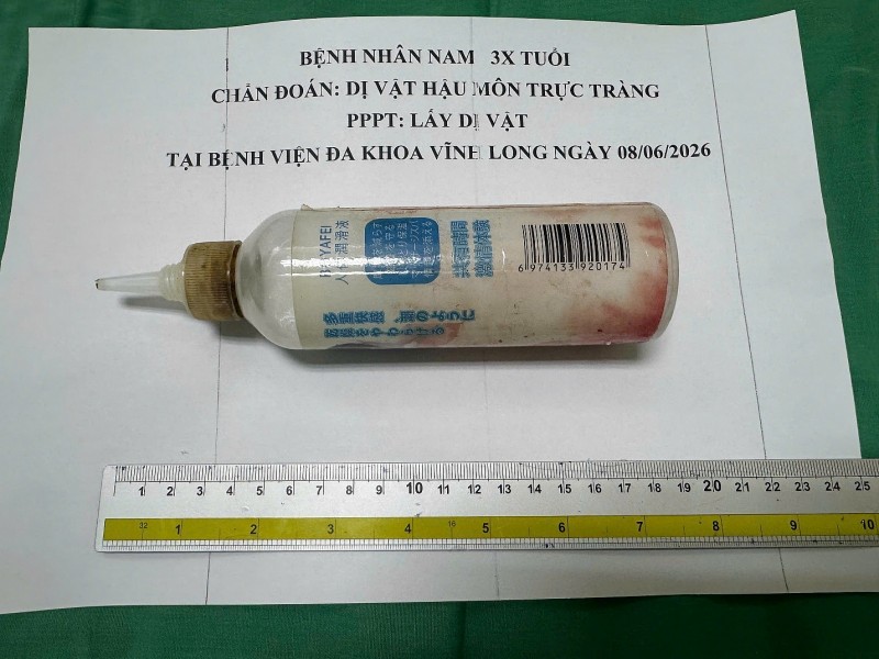 Kịp thời phẫu thuật lấy dị vật chai nhựa gần 20 cm trong trực tràng cho nam bệnh nhân 34 tuổi Kịp thời phẫu thuật lấy dị vật chai nhựa gần 20 cm trong trực tràng cho nam bệnh nhân 34 tuổi