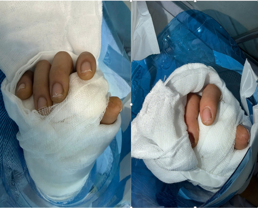Bệnh viện hữu nghị Việt Tiệp nơi viết tiếp những điều tưởng chừng không thể bằng kỹ thuật vi phẫu hiện đại Bệnh viện hữu nghị Việt Tiệp: nơi viết tiếp những điều tưởng chừng không thể bằng kỹ thuật vi phẫu hiện đại