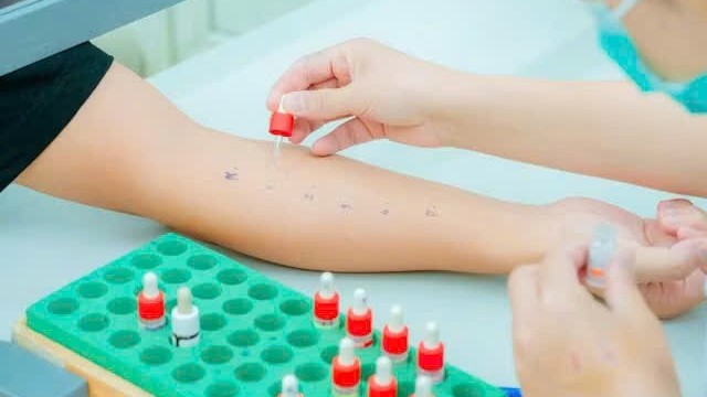 Nguy cơ khó lường từ dị ứng thuốc và thức ăn