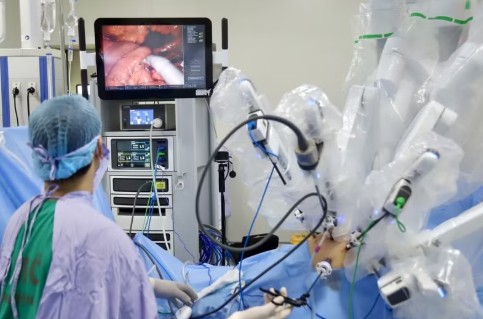 Ung thư trực tràng có xu hướng trẻ hóa, số ca mắc gia tăng