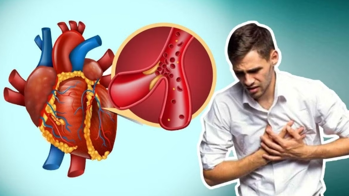 Gút không chỉ gây đau khớp: Những biến chứng ít người ngờ tới