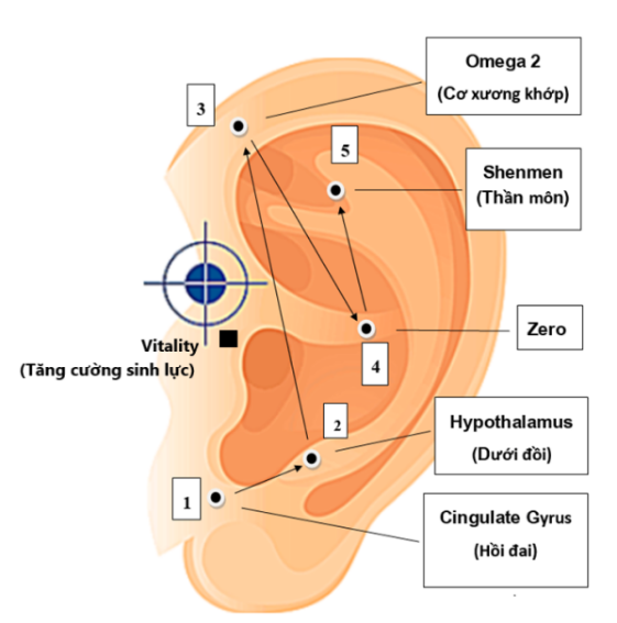 Cấy Chỉ Trong Phục Hồi Chức Năng Sau Đột Quỵ: Cơ chế tính dẻo thần kinh (Neuroplasticity) và kinh nghiệm lâm sàng từ mô hình điều trị tích hợp. Cấy Chỉ Trong Phục Hồi Chức Năng Sau Đột Quỵ: Cơ chế tính dẻo thần kinh (Neuroplasticity) và kinh nghiệm lâm sàng từ mô hình điều trị tích hợp.