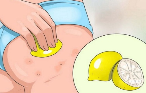 Tổng hợp những cách trị thâm body nách, bẹn, mông cực hiệu quả Tổng hợp những cách trị thâm body nách, bẹn, mông cực hiệu quả