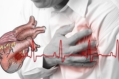 Cảnh báo 3 thời điểm nguy hiểm trong ngày dễ xảy ra đột qụy