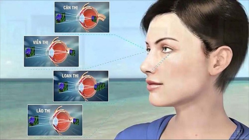 Nền kinh tế đằng sau những đôi mắt Nền kinh tế đằng sau những đôi mắt