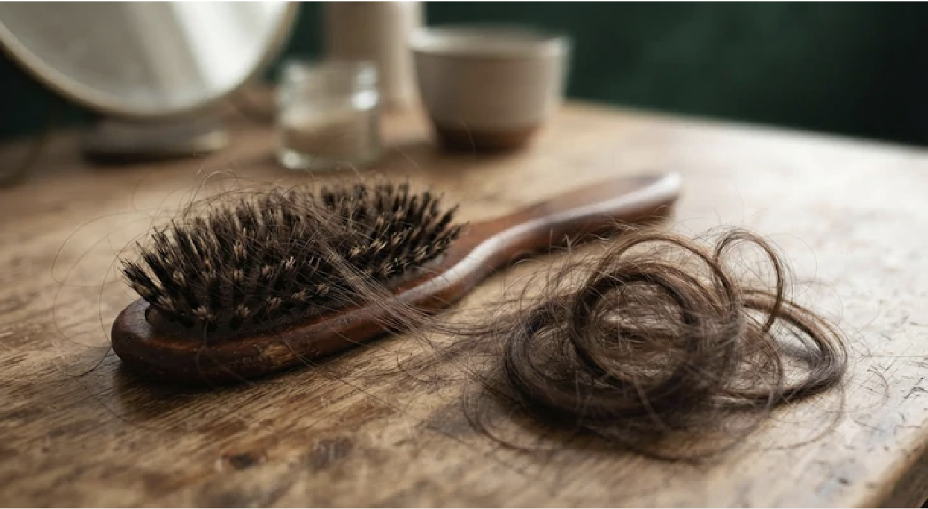 Rụng tóc là vấn đề khá phổ biến, phần lớn trường hợp có thể cải thiện qua điều chỉnh sinh hoạt và chăm sóc đúng cách. Ảnh minh họa AI.