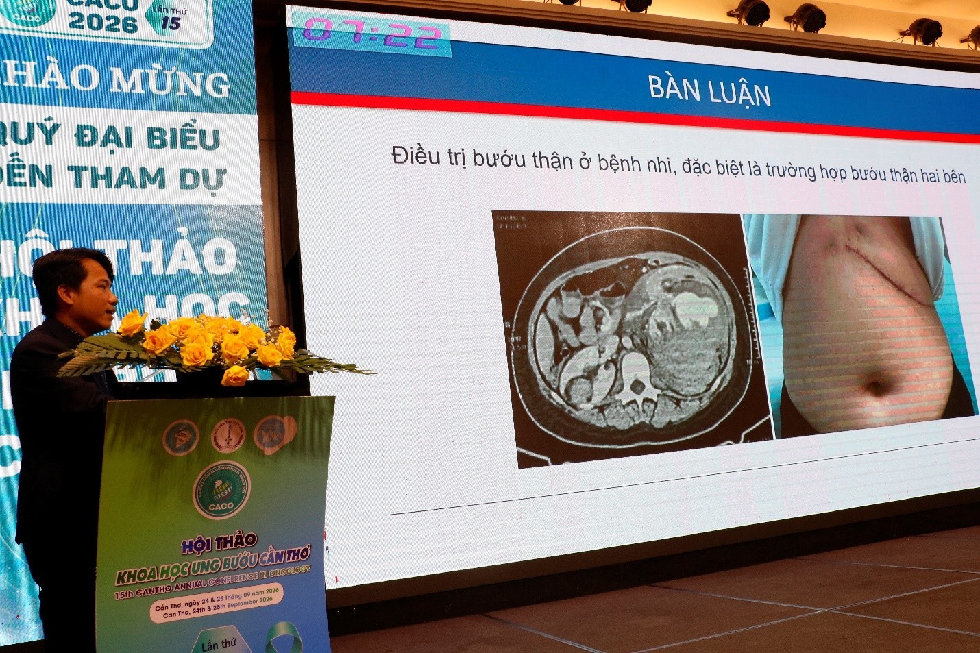 Nâng cao hiệu quả điều trị cho bệnh nhân ung thư Nâng cao hiệu quả điều trị cho bệnh nhân ung thư