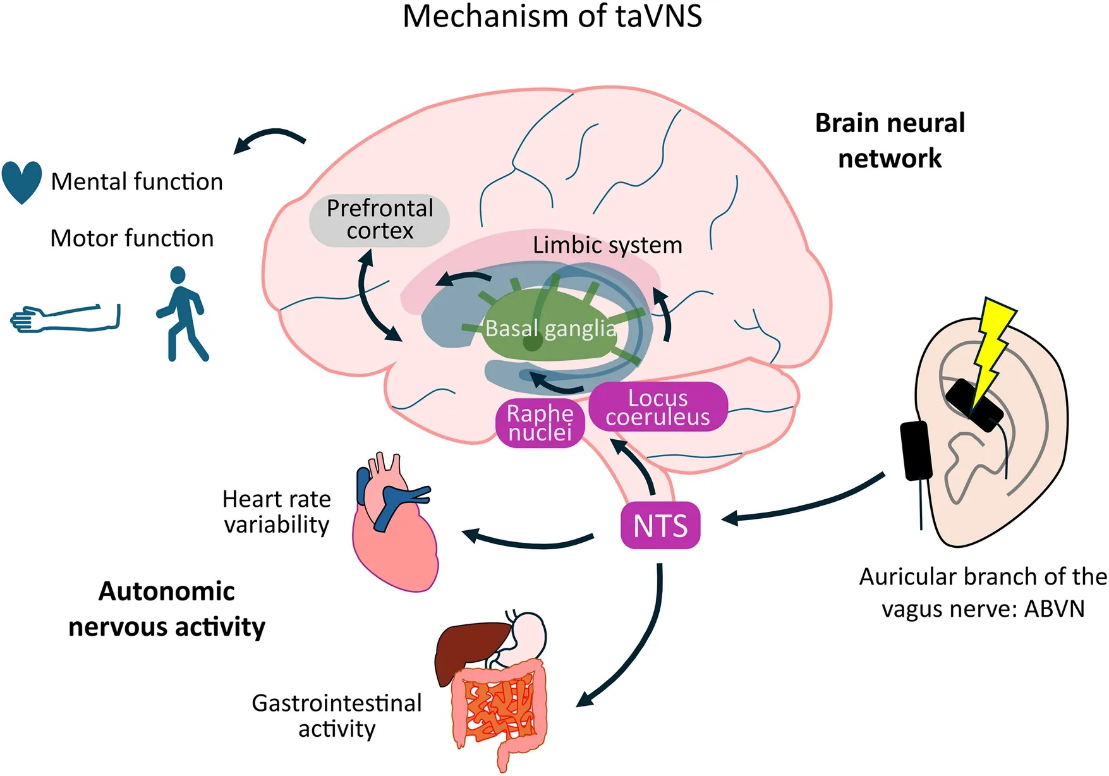 Vai Trò Của Châm Cứu Và Nhĩ Châm Trong Hỗ Trợ Điều Trị Bệnh Parkinson