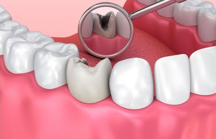 Ăn nhiều kẹo có thể khiến bạn mất ngủ và tăng nguy cơ mắc bệnh tim mạch Ăn nhiều kẹo có thể khiến bạn mất ngủ và tăng nguy cơ mắc bệnh tim mạch
