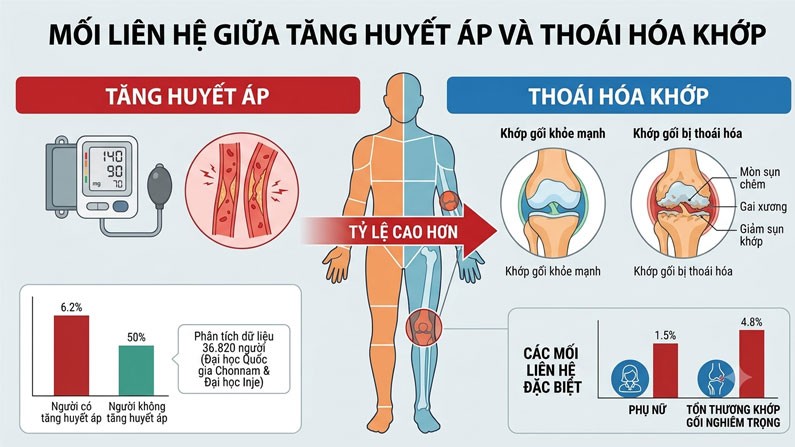 Huyết áp cao có thể khiến thoái hóa khớp tiến triển nhanh hơn Huyết áp cao có thể khiến thoái hóa khớp tiến triển nhanh hơn