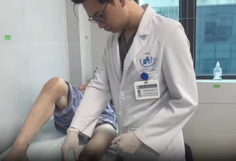 Vết loét chân kéo dài không lành có thể là dấu hiệu của bệnh lý tĩnh mạch