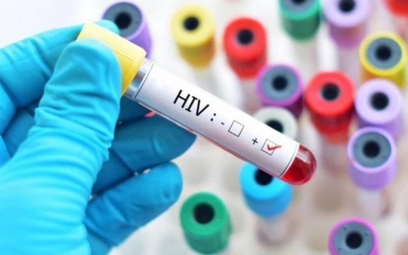 Quy định mới về cấp giấy chứng nhận bị phơi nhiễm HIV do tai nạn rủi ro nghề nghiệp Quy định mới về cấp giấy chứng nhận bị phơi nhiễm HIV do tai nạn rủi ro nghề nghiệp