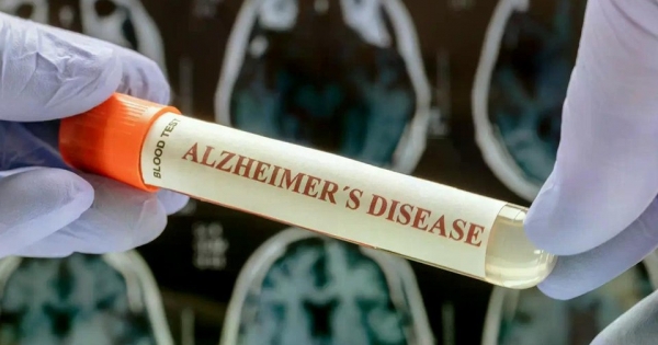 Phát hiện khoa học mới mở ra hy vọng kiểm soát bệnh Alzheimer