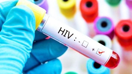 Phát hiện đột phá mở đường cho khả năng chữa khỏi HIV