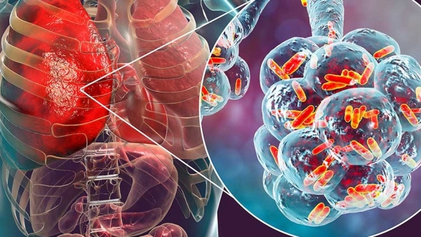 ECDC cảnh báo về dịch bệnh Legionnaire tại châu Âu